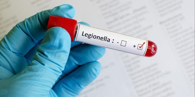 Legionella