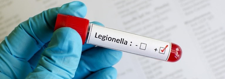 Legionella nieuw